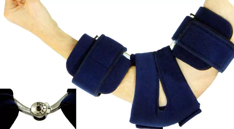 nerv-ulnar3