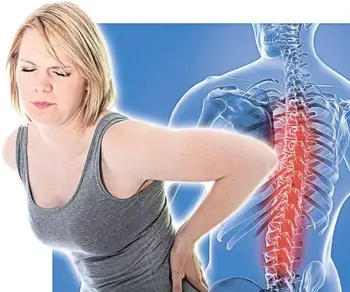 sciatica2